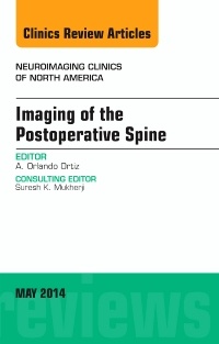 Couverture de l’ouvrage Imaging of the Postoperative Spine, An Issue of Neuroimaging Clinics