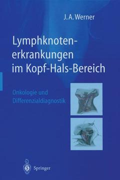 Couverture de l’ouvrage Lymphknotenerkrankungen im Kopf-Hals-Bereich