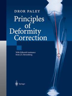 Couverture de l’ouvrage Principles of Deformity Correction