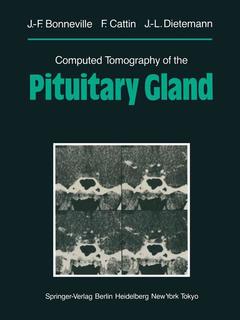Couverture de l’ouvrage Computed Tomography of the Pituitary Gland