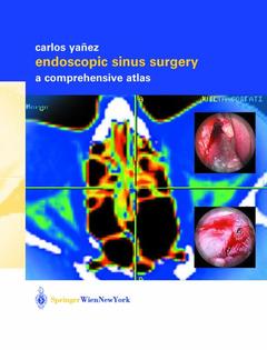 Couverture de l’ouvrage Endoscopic Sinus Surgery