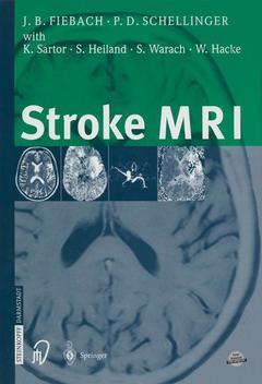 Couverture de l’ouvrage Stroke MRI