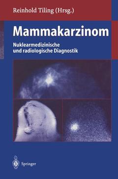 Cover of the book Mammakarzinom