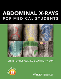 Cover of the book Abdominal X-rays for Medical Students