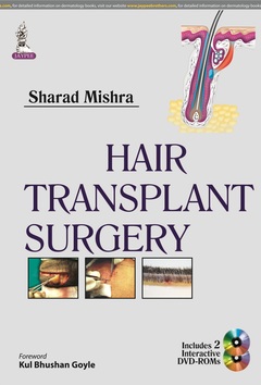 Couverture de l’ouvrage Hair Transplant Surgery
