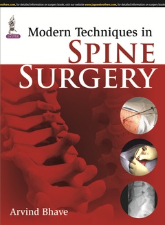 Couverture de l’ouvrage Modern Techniques in Spine Surgery