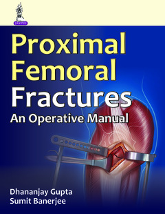 Couverture de l’ouvrage An Operative Manual of Proximal Femoral Fractures