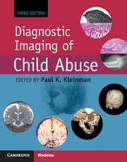 Couverture de l’ouvrage Diagnostic Imaging of Child Abuse