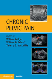 Cover of the book Chronic Pelvic Pain