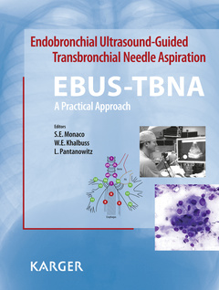 Couverture de l’ouvrage Endobronchial Ultrasound-Guided Transbronchial Needle Aspiration (EBUS-TBNA): A Practical Approach