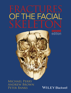 Couverture de l’ouvrage Fractures of the Facial Skeleton