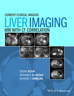 Cover of the book Liver Imaging