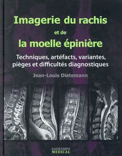 Cover of the book IMAGERIE DU RACHIS ET DE LA MOELLE EPINIERE