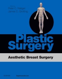 Cover of the book Plastic Surgery: Aesthetic Breast Surgery Access Code