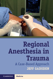Couverture de l’ouvrage Regional Anesthesia in Trauma