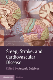 Cover of the book Sleep, Stroke and Cardiovascular Disease