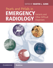 Couverture de l’ouvrage Pearls and Pitfalls in Emergency Radiology