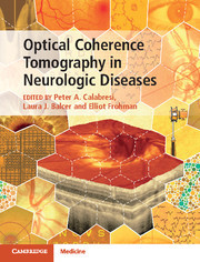 Couverture de l’ouvrage Optical Coherence Tomography in Neurologic Diseases