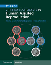 Couverture de l’ouvrage Atlas of Vitrified Blastocysts in Human Assisted Reproduction