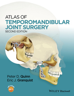 Couverture de l’ouvrage Atlas of Temporomandibular Joint Surgery
