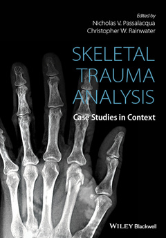 Couverture de l’ouvrage Skeletal Trauma Analysis