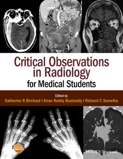 Couverture de l’ouvrage Critical Observations in Radiology for Medical Students