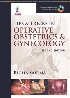 Couverture de l’ouvrage Tips & Tricks in Operative Obstetrics & Gynecology