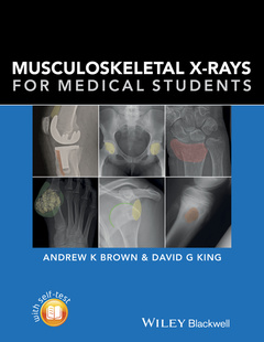 Cover of the book Musculoskeletal X-Rays for Medical Students and Trainees