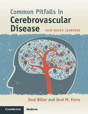 Couverture de l’ouvrage Common Pitfalls in Cerebrovascular Disease