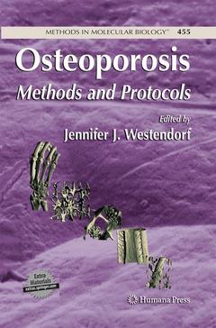 Cover of the book Osteoporosis
