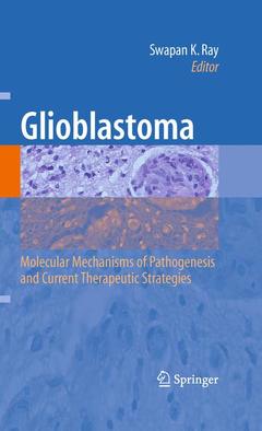 Cover of the book Glioblastoma: