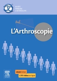 Couverture de l’ouvrage L'arthroscopie