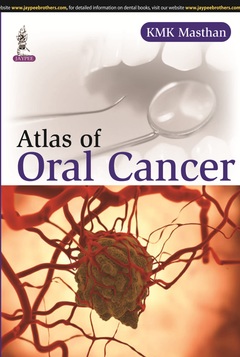 Couverture de l’ouvrage Color Atlas of Oral Cancer