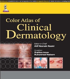 Cover of the book Color Atlas of Clinical Dermatology