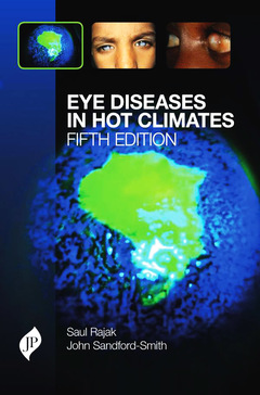 Couverture de l’ouvrage Eye Diseases in Hot Climates