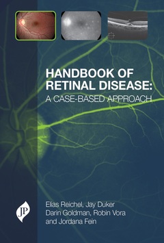 Couverture de l’ouvrage Handbook of Retinal Disease: a Case-based Approach