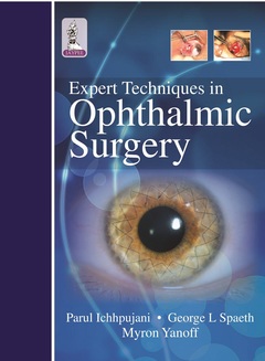 Couverture de l’ouvrage Expert Techniques in Ophthalmic Surgery