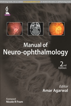 Couverture de l’ouvrage Manual of Neuro-ophthalmology
