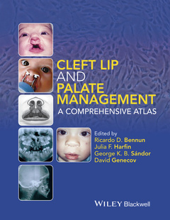 Couverture de l’ouvrage Cleft Lip and Palate Management