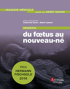 Cover of the book Imagerie : du fœtus au nouveau-né