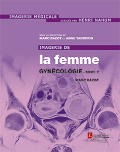 Couverture de l’ouvrage Imagerie de la femme : Gynécologie - Tome 2