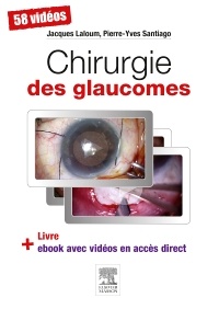 Couverture de l’ouvrage Chirurgie des glaucomes