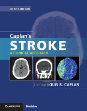 Couverture de l’ouvrage Caplan's Stroke