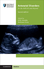 Couverture de l’ouvrage Antenatal Disorders for the MRCOG and Beyond