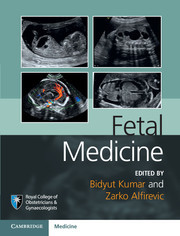 Couverture de l’ouvrage Fetal Medicine