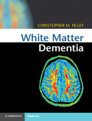 Cover of the book White Matter Dementia
