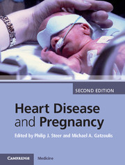 Cover of the book Heart Disease and Pregnancy