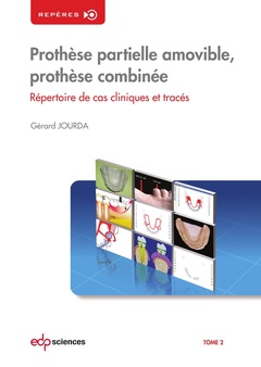 Cover of the book PROTHESE PARTIELLE AMOVIBLE T2