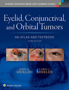 Couverture de l’ouvrage Eyelid, Conjunctival, and Orbital Tumors: An Atlas and Textbook