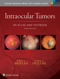 Couverture de l’ouvrage Intraocular Tumors: An Atlas and Textbook